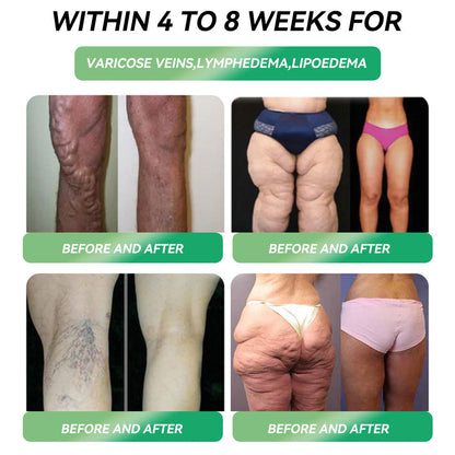 Only 10 boxes left! ⏰ Grab an exclusive 70% discount! Recommended by endocrinologists: 4 to 6 boxes to stabilize weight loss and prevent rebound. Last chance before next year! Don’t wait! 🔥